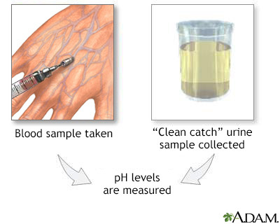 Pregnancy Smartsite Urine Ph Test