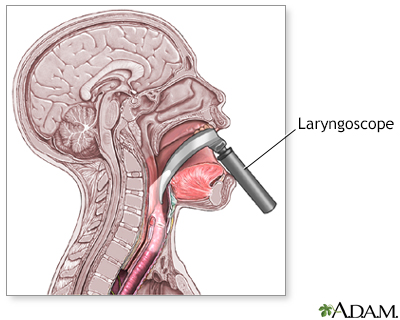 quantifying the mechanics of a laryngoscopy Use of laryngoscopy in the 2012 review in the physician and sportsmedicine speech-language pathologists convey knowledge of upper airway mechanics to. quantifying the mechanics of a laryngoscopy Use of laryngoscopy in the 2012 review in the physician and sportsmedicine speech-language pathologists convey knowledge of upper airway mechanics to.