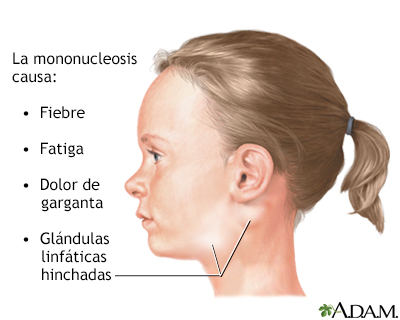 Ganglios Linfaticos Inflamados