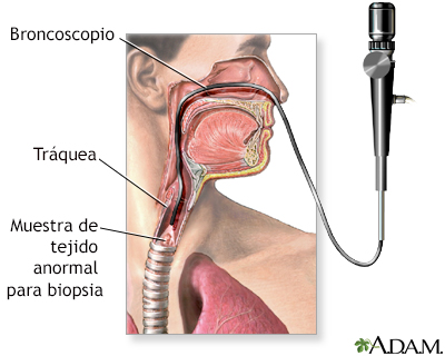 Examen de las vías respiratorias superiores