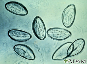 Huevos de lombrices intestinales