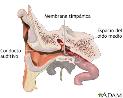 Inserción de un tubo en el oído - serie - Anatomía normal