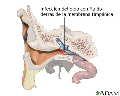 Indicaciones