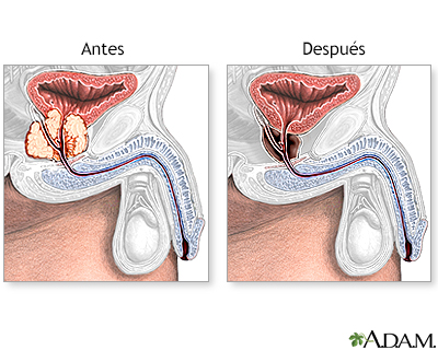 Cuidados postoperatorios