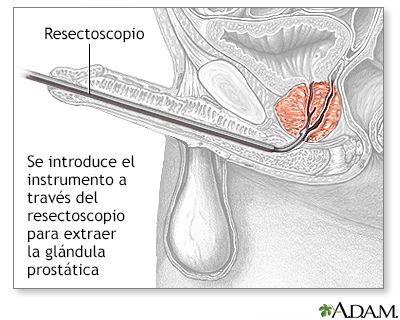 Procedimiento