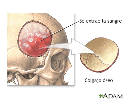 Procedimiento