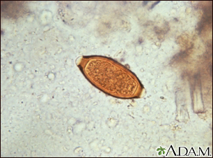 Huevo de Trichuris trichiura