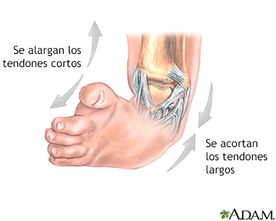 Procedimiento (segunda parte)