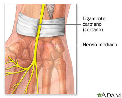 Procedimiento