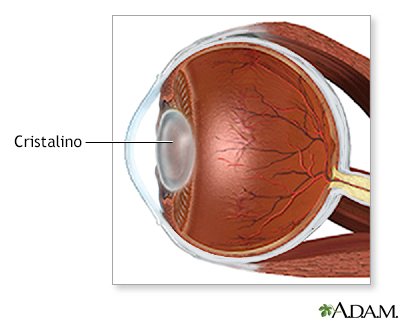 Serie de la cirugía de cataratas - Anatomía normal