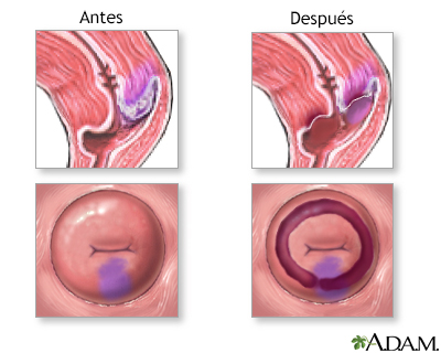 Cuidados postoperatorios