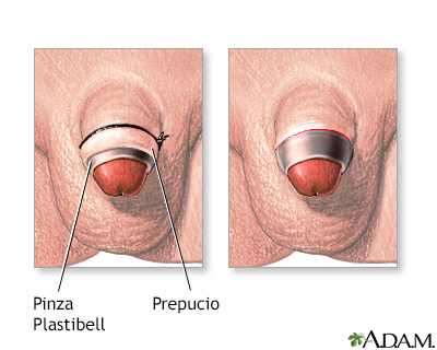 Procedimiento