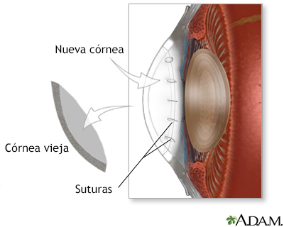 Procedimiento