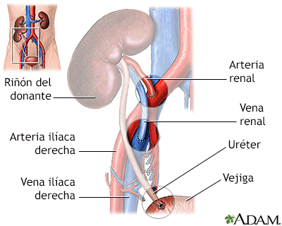 Procedimiento