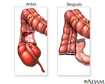 Cuidados postoperatorios