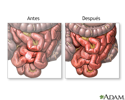 Cuidados postoperatorios