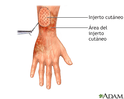 Procedimiento