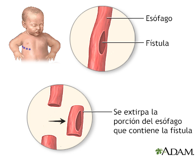 Procedimiento (primera parte)