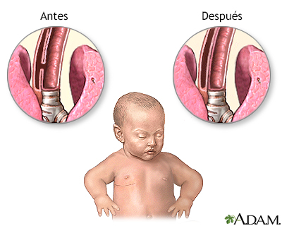 Cuidados postoperatorios