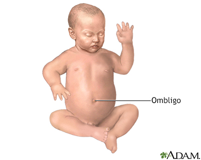 Reparación quirúrgica de una hernia umbilical - serie - Anatomía normal