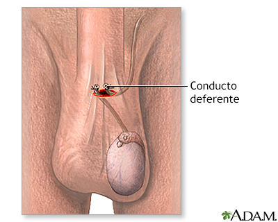 Procedimiento