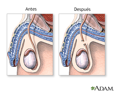 Cuidados postoperatorios