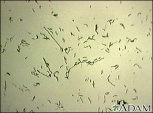 Organismo Campylobacter jejuni