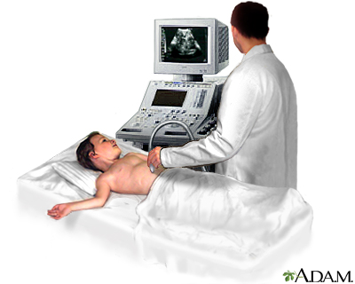 Ultrasonido abdominal