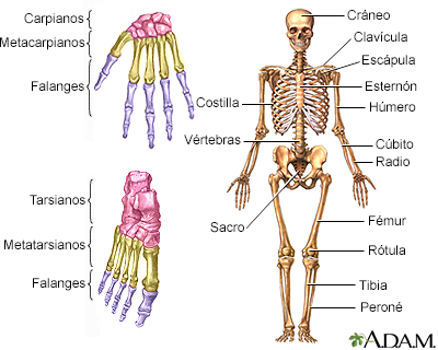 esqueleto de cáncer de hueso