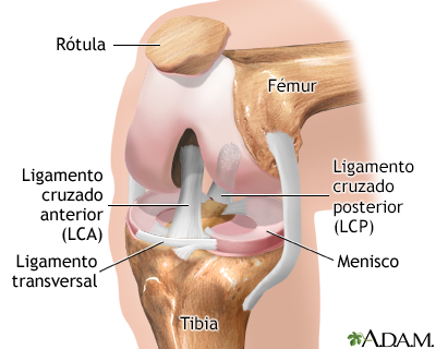 Cómo lidiar con una rodilla dislocada (con imágenes)