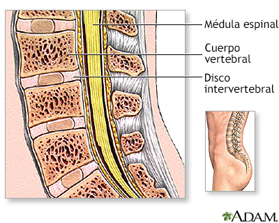 Cirugía de columna lumbar - Serie