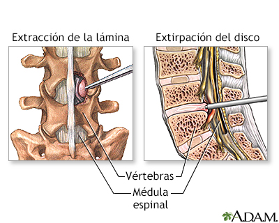 Procedimiento