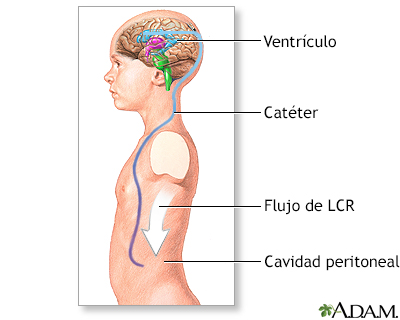 Procedimiento