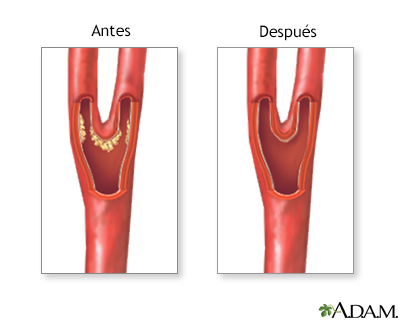 Cuidados postoperatorios