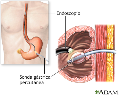 Procedimiento (segunda parte)