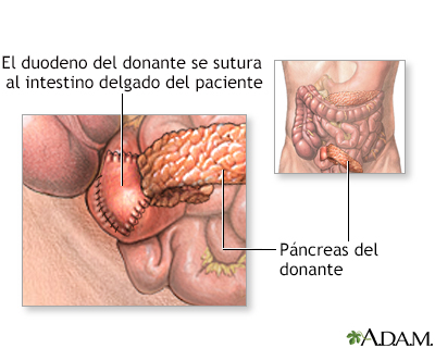 Procedimiento (primera parte)