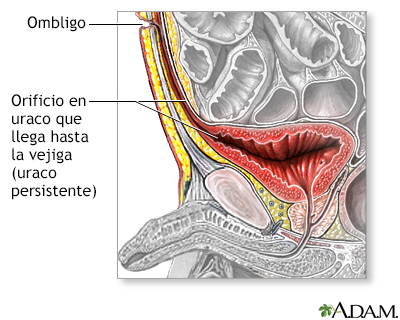 Indicaciones