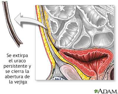 Procedimiento