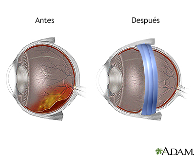 Cuidados postoperatorios