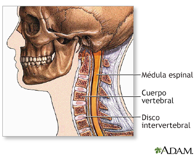 Cirugía de la columna cervical - Serie