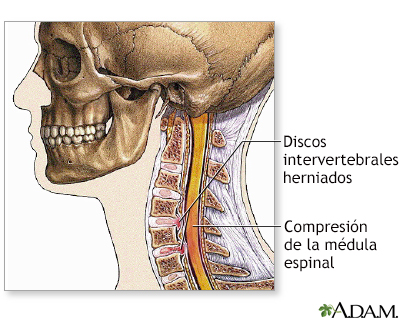 Indicaciones