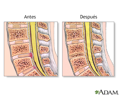 Cuidados postoperatorios