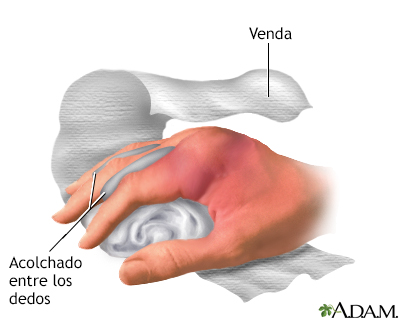 Indicaciones, parte 1