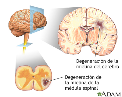 Indicaciones