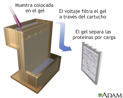 Procedimiento (tercera parte)