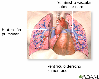 Indicaciones