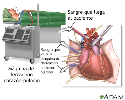 Procedimiento, parte 1