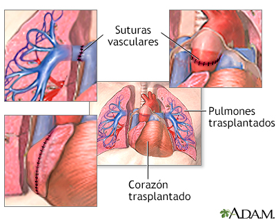 Procedimiento, parte 2