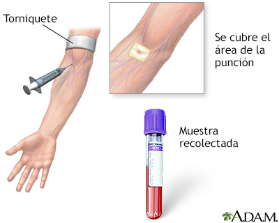 Procedimiento