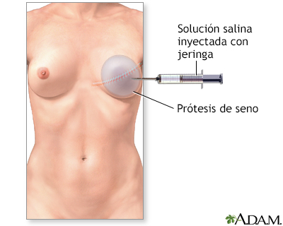 Procedimiento (segunda parte)